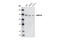 DNA Methyltransferase 3 Alpha antibody, 2160S, Cell Signaling Technology, Western Blot image 