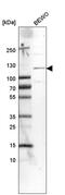 Beta-1,4-N-Acetyl-Galactosaminyltransferase 3 antibody, HPA011404, Atlas Antibodies, Western Blot image 