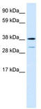 Vacuolar Protein Sorting 72 Homolog antibody, TA334738, Origene, Western Blot image 