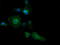 Phosphatidylinositol-4-Phosphate 3-Kinase Catalytic Subunit Type 2 Beta antibody, LS-C174638, Lifespan Biosciences, Immunofluorescence image 
