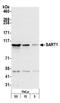 Spliceosome Associated Factor 1, Recruiter Of U4/U6.U5 Tri-SnRNP antibody, A301-423A, Bethyl Labs, Western Blot image 