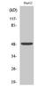 Endothelin Receptor Type A antibody, STJ93005, St John