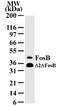 FosB Proto-Oncogene, AP-1 Transcription Factor Subunit antibody, TA336391, Origene, Western Blot image 