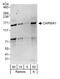 Caspase recruitment domain-containing protein 11 antibody, A302-543A, Bethyl Labs, Western Blot image 
