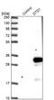 D-Aminoacyl-TRNA Deacylase 1 antibody, NBP1-88776, Novus Biologicals, Western Blot image 