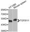 Transforming Growth Factor Beta 1 Induced Transcript 1 antibody, STJ110757, St John