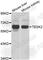 Testis Associated Actin Remodelling Kinase 2 antibody, A7460, ABclonal Technology, Western Blot image 