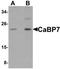 Calcium-binding protein 7 antibody, TA320125, Origene, Western Blot image 