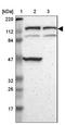 Diaphanous Related Formin 2 antibody, NBP1-85217, Novus Biologicals, Western Blot image 