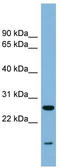 Trafficking protein particle complex subunit 4 antibody, TA345061, Origene, Western Blot image 