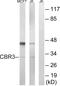 Carbonyl Reductase 3 antibody, PA5-39079, Invitrogen Antibodies, Western Blot image 