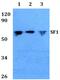 Splicing Factor 1 antibody, PA5-36103, Invitrogen Antibodies, Western Blot image 