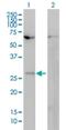 Homeobox B7 antibody, H00003217-M01, Novus Biologicals, Western Blot image 