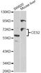 CES2 antibody, MBS127837, MyBioSource, Western Blot image 