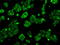 Aconitase antibody, GTX84963, GeneTex, Immunocytochemistry image 