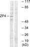 Zona pellucida sperm-binding protein 4 antibody, GTX87417, GeneTex, Western Blot image 