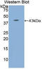 Complement component C8 beta chain antibody, LS-C293497, Lifespan Biosciences, Western Blot image 