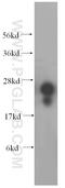N-Terminal Xaa-Pro-Lys N-Methyltransferase 1 antibody, 17184-1-AP, Proteintech Group, Western Blot image 