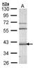 Calcium/Calmodulin Dependent Protein Kinase ID antibody, LS-C186002, Lifespan Biosciences, Western Blot image 