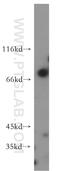 Eukaryotic translation initiation factor 2-alpha kinase 1 antibody, 20499-1-AP, Proteintech Group, Western Blot image 