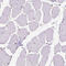 Regulator Of Microtubule Dynamics 3 antibody, HPA009975, Atlas Antibodies, Immunohistochemistry frozen image 