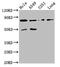 Neuroendocrine convertase 2 antibody, CSB-PA017642LA01HU, Cusabio, Western Blot image 