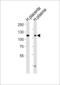 Autotaxin antibody, LS-C167766, Lifespan Biosciences, Western Blot image 