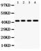 Haptoglobin antibody, LS-C344073, Lifespan Biosciences, Western Blot image 
