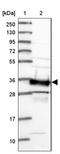 Survival Of Motor Neuron 2, Centromeric antibody, NBP2-46712, Novus Biologicals, Western Blot image 