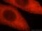 Complexin 3 antibody, 16949-1-AP, Proteintech Group, Immunofluorescence image 
