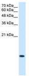 BRICK1 Subunit Of SCAR/WAVE Actin Nucleating Complex antibody, TA339895, Origene, Western Blot image 