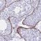 Elastin antibody, HPA056941, Atlas Antibodies, Immunohistochemistry paraffin image 