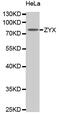 Zyxin antibody, MBS126125, MyBioSource, Western Blot image 