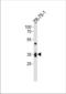 Interleukin-3 receptor subunit alpha antibody, TA325019, Origene, Western Blot image 