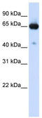 Solute Carrier Family 39 Member 4 antibody, TA333766, Origene, Western Blot image 