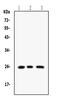 RAB14, Member RAS Oncogene Family antibody, PB9815, Boster Biological Technology, Western Blot image 