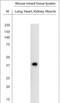 Potassium Voltage-Gated Channel Subfamily J Member 10 antibody, NBP1-20149, Novus Biologicals, Western Blot image 