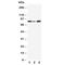 Minichromosome Maintenance Complex Component 5 antibody, R30737, NSJ Bioreagents, Western Blot image 