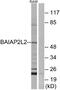 BAI1 Associated Protein 2 Like 2 antibody, A30580, Boster Biological Technology, Western Blot image 