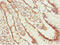 Notchless Homolog 1 antibody, LS-C676162, Lifespan Biosciences, Immunohistochemistry paraffin image 