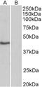 TATA-Box Binding Protein antibody, LS-C154976, Lifespan Biosciences, Western Blot image 