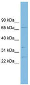 GRB2 Related Adaptor Protein antibody, TA340121, Origene, Western Blot image 