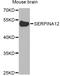 Serpin Family A Member 12 antibody, A05352, Boster Biological Technology, Western Blot image 