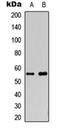 Cytochrome P450 Family 2 Subfamily S Member 1 antibody, orb256488, Biorbyt, Western Blot image 