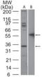 FAS antibody, NBP2-29473, Novus Biologicals, Western Blot image 
