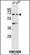 Protein Tyrosine Phosphatase Non-Receptor Type 11 antibody, MBS9209068, MyBioSource, Western Blot image 