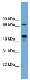 Zinc finger protein 496 antibody, TA329602, Origene, Western Blot image 