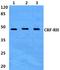 Corticotropin Releasing Hormone Receptor 2 antibody, A02945, Boster Biological Technology, Western Blot image 