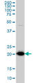 Fortilin antibody, LS-C198363, Lifespan Biosciences, Western Blot image 