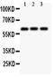 Perforin 1 antibody, PA5-79865, Invitrogen Antibodies, Western Blot image 